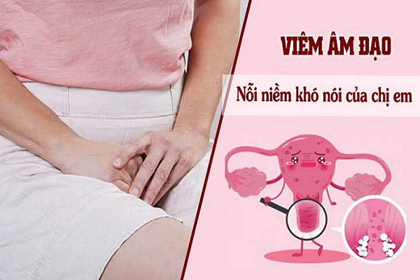 Viêm âm đạo là bệnh phụ khoa thường gặp nhất ở phụ nữ